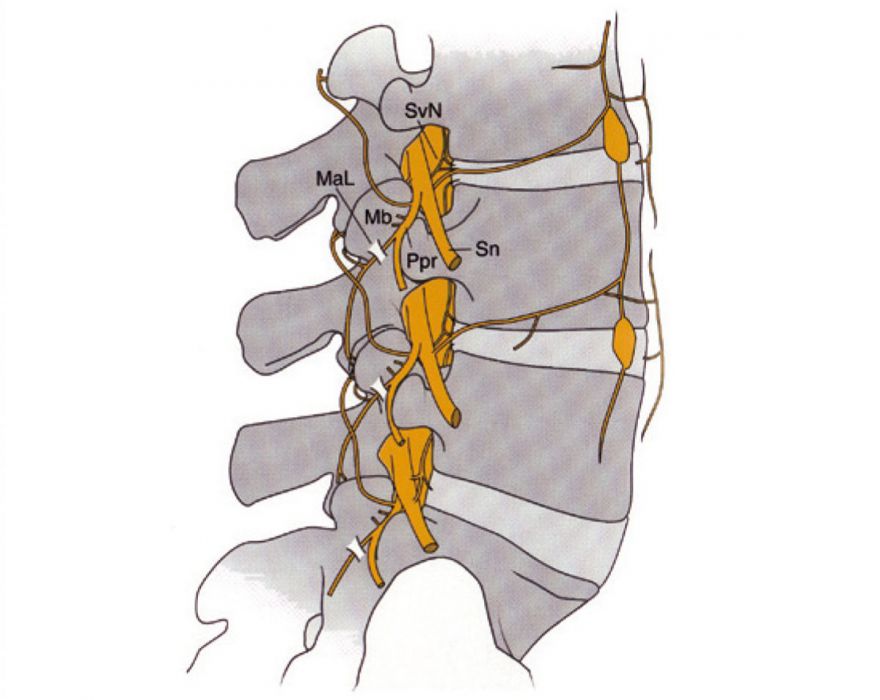 CT gesteuerte Schmerztherapie