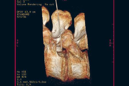 5 prt lws 3d darstellung 5 prt lws 3d darstellung